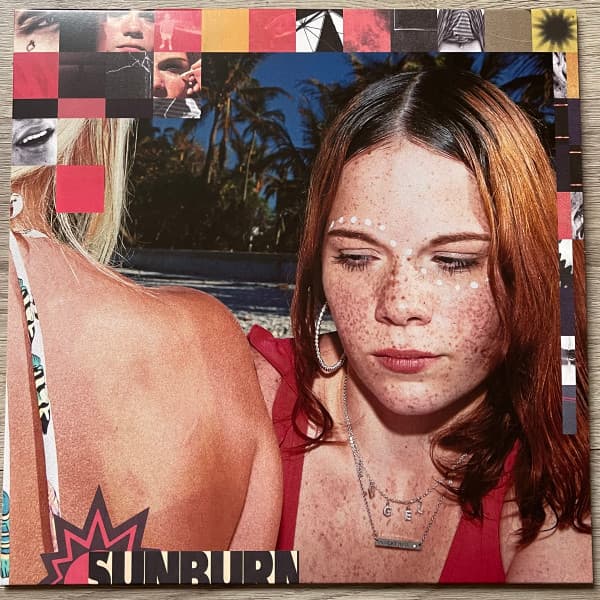 FIKE, DOMINIC – FIKE, DOMINIC – SUNBURN